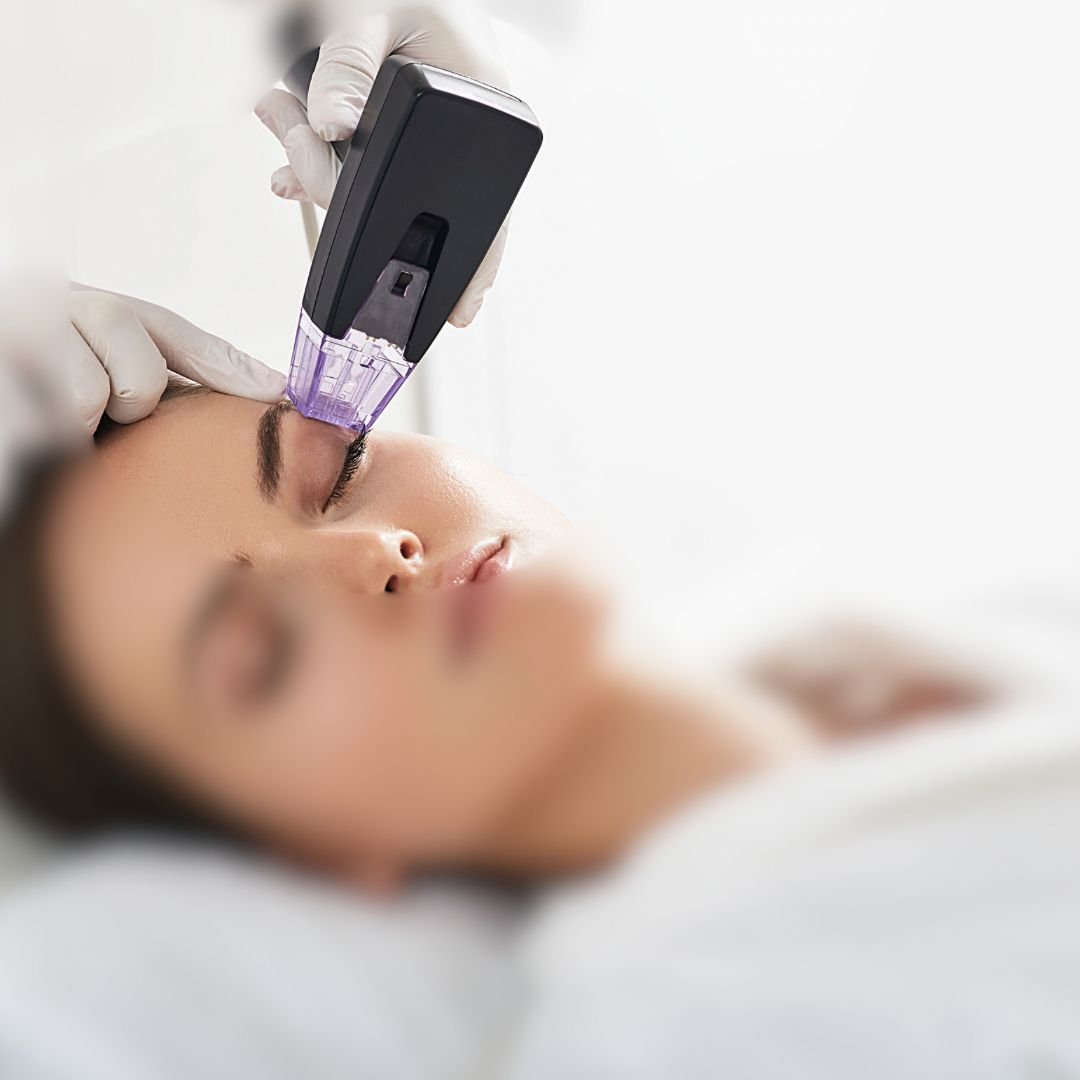 foto-radiofrecuencia-Golden-age-aurora-escribano-esteticista-cosmetóloga