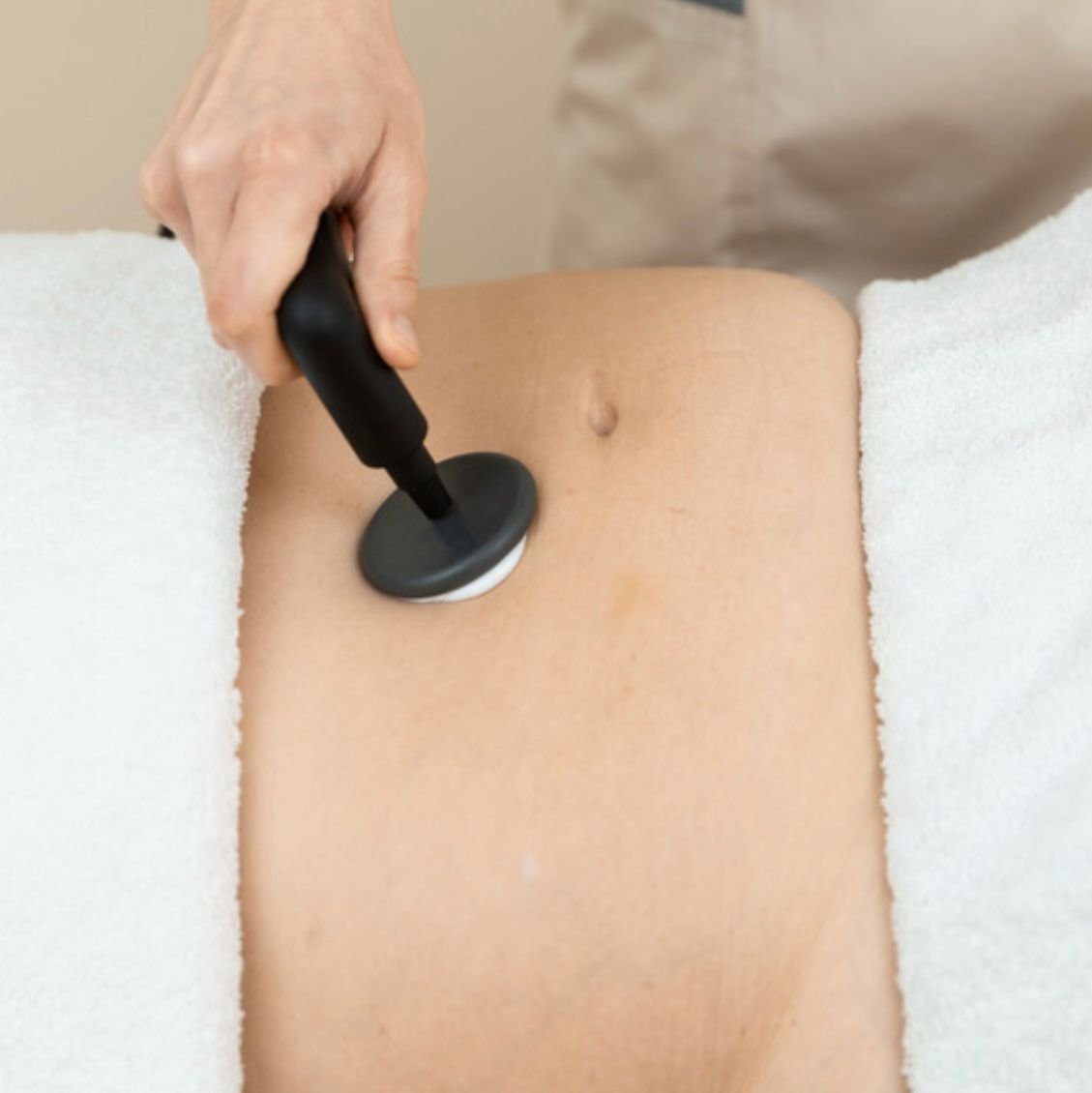 foto-radiofrecuencia-capacitiva-aurora-escribano-esteticista-cosmetóloga